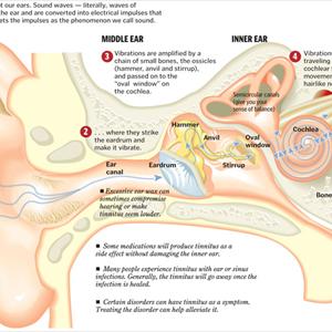 Tinnitus Treatments 2006 - Tinnitus - Is This Ringing In My Ear An Illness And Can Others Hear What I Am Hearing?